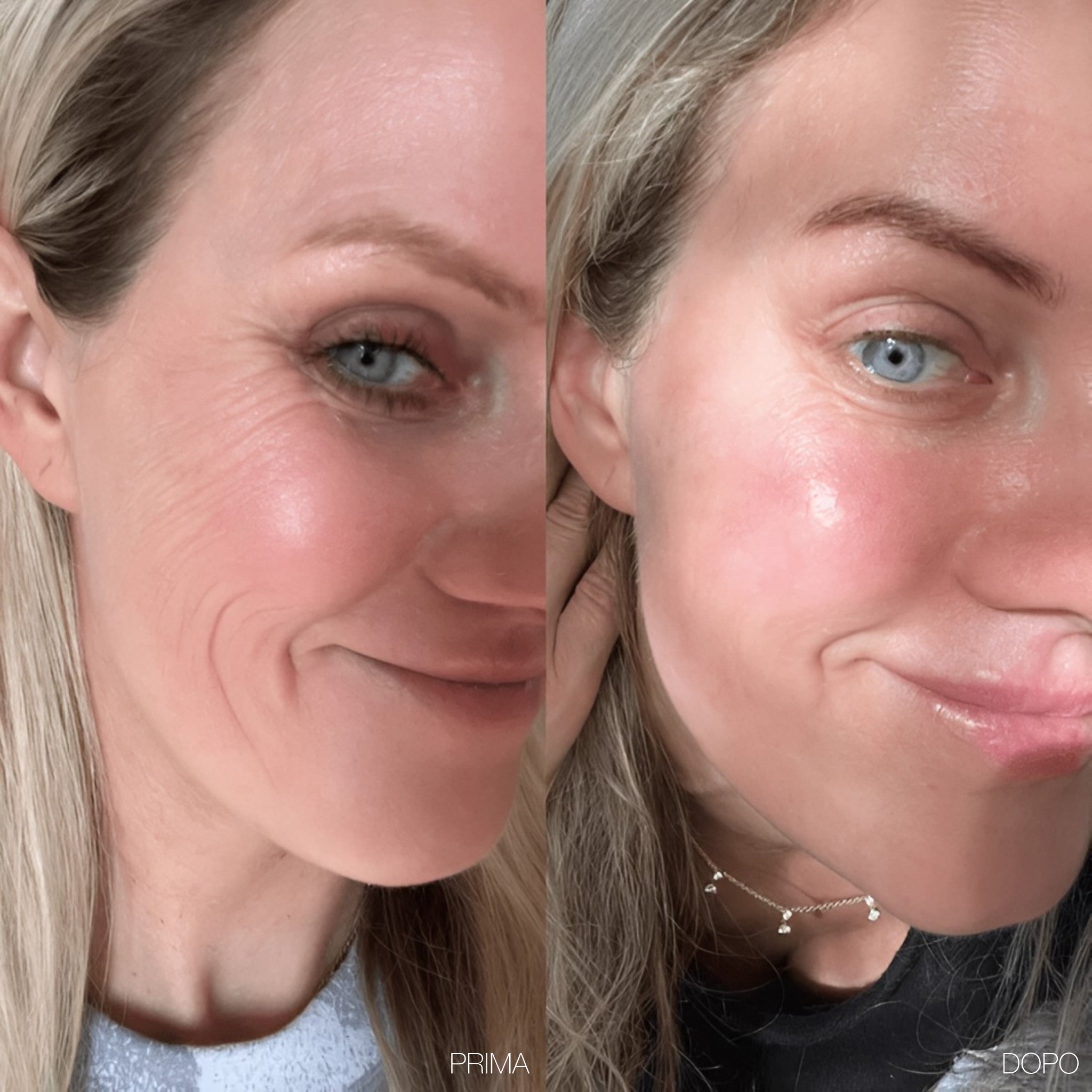 Roxy- 6 in 1 Derma Roller in Titanio