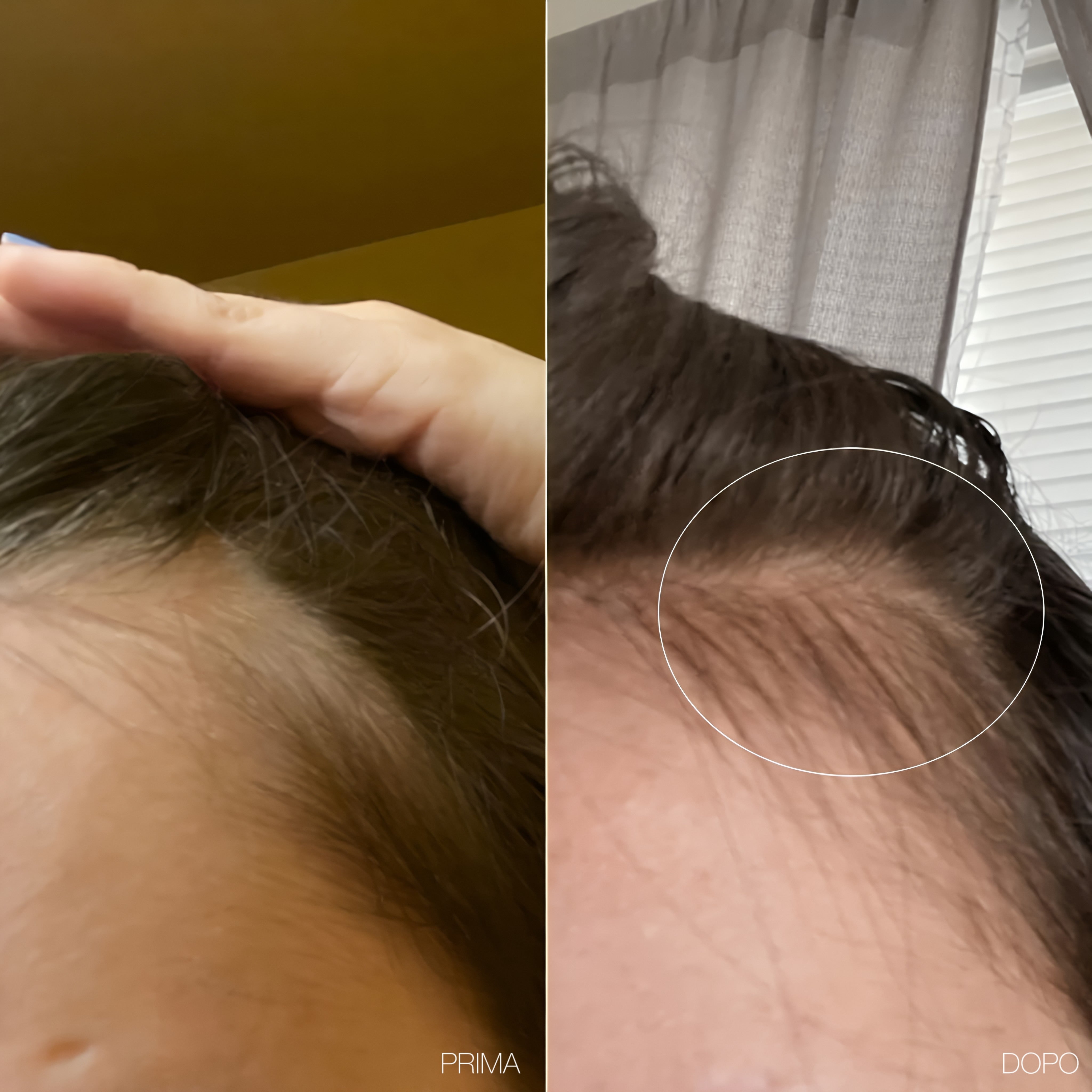 Roxy- 6 in 1 Derma Roller in Titanio